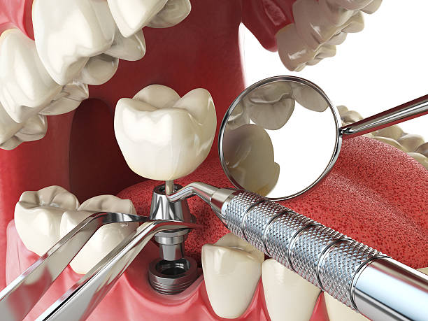 Best Weekend Emergency Dentist in Whitehall, OH